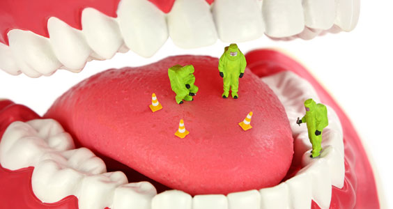 Ağız Kokusu Nasıl Önlenir