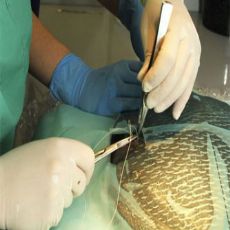 Balığa Fıtık Ameliyatı Yapıldı