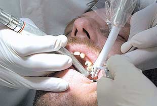 SGK'dan Diş Hastalarına Müjde