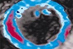 Kalp Krizinin Fotoğrafı Çekildi