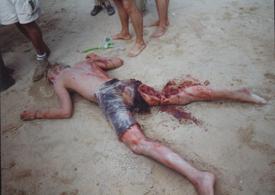 Köpekbalığı Saldırısında Bir Genç Oldu