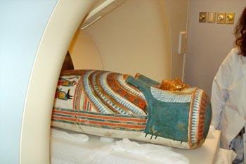 4300 Yıllık Muma Bulundu