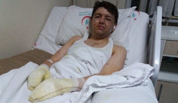 (Özel Haber) Patlamada Yaralananlar Dehşet Anlarını Anlattı